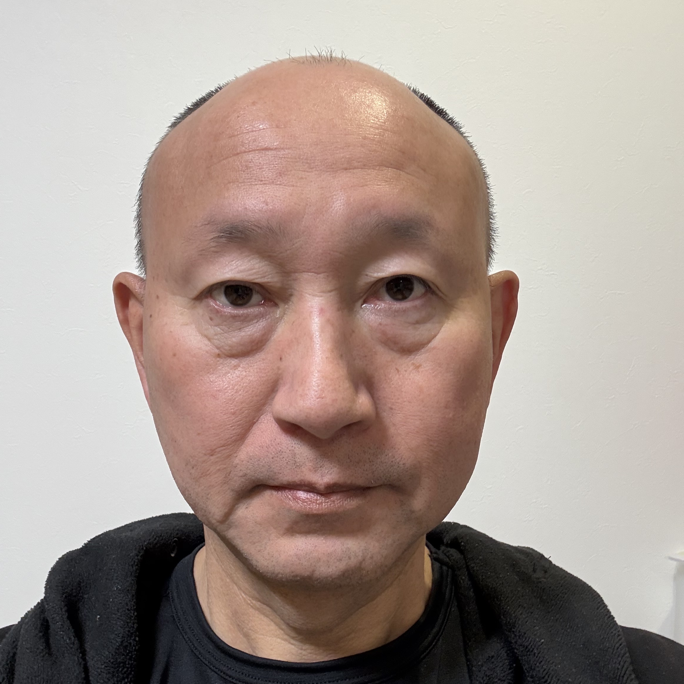 「今が最後かもしれない」そう感じて踏み切った2回目の購入